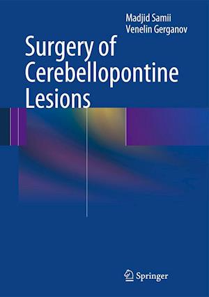 Surgery of Cerebellopontine Lesions