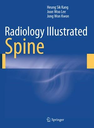 Radiology Illustrated: Spine