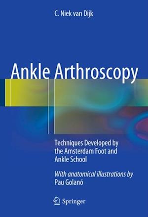 Ankle Arthroscopy