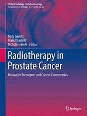 Radiotherapy in Prostate Cancer