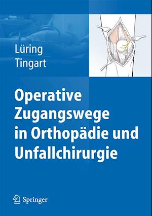 Operative Zugangswege in Orthopädie Und Unfallchirurgie