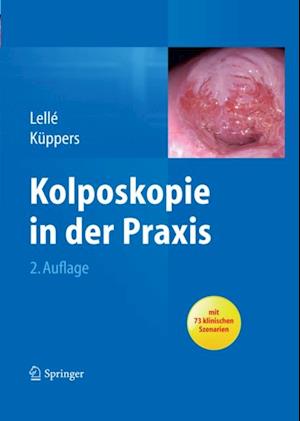 Kolposkopie in der Praxis