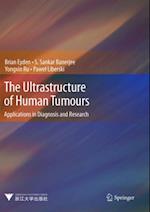 Ultrastructure of Human Tumours