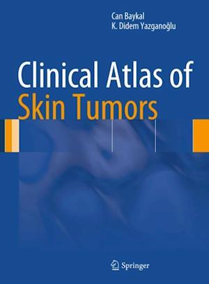 Clinical Atlas of Skin Tumors