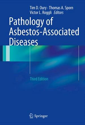 Pathology of Asbestos-Associated Diseases