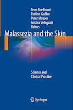 Malassezia and the Skin