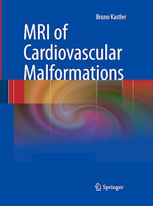 MRI of Cardiovascular Malformations