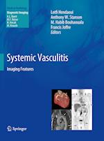 Systemic Vasculitis