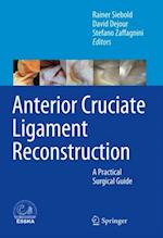 Anterior Cruciate Ligament Reconstruction