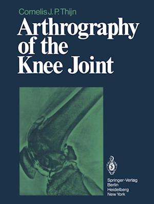 Arthrography of the Knee Joint