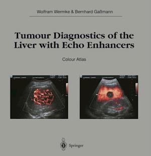 Tumour Diagnostics of the Liver with Echo Enhancers