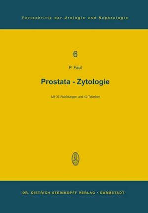 Prostata-Zytologie