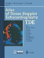 Atlas of Tissue Doppler Echocardiography — TDE