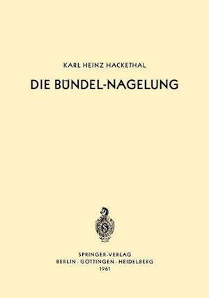 Die Bündel-Nagelung