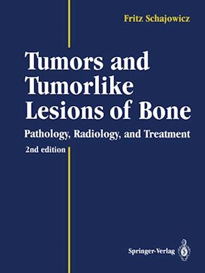 Tumors and Tumorlike Lesions of Bone