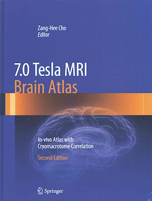 7.0 Tesla MRI Brain Atlas