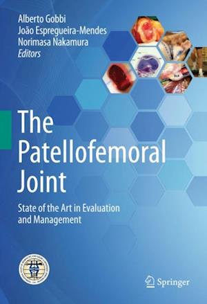 Patellofemoral Joint