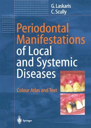 Periodontal Manifestations of Local and Systemic Diseases