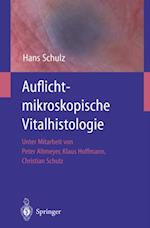 Auflichtmikroskopische Vitalhistologie