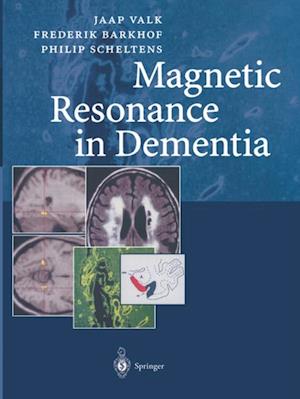 Magnetic Resonance in Dementia