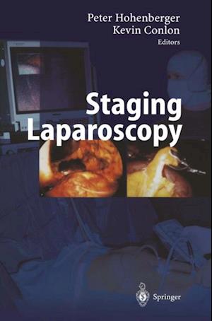 Staging Laparoscopy