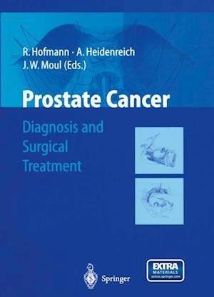 Prostate Cancer