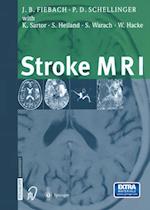 Stroke MRI