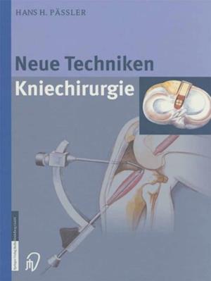 Neue Techniken Kniechirurgie