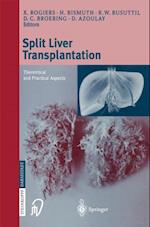 Split liver transplantation