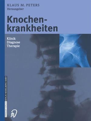 Knochenkrankheiten