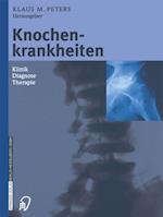 Knochenkrankheiten