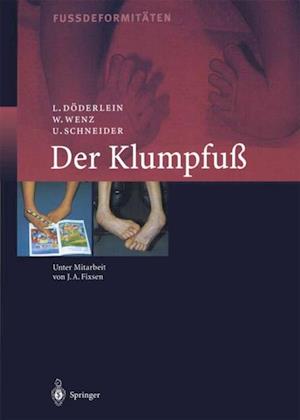 Der Klumpfuss