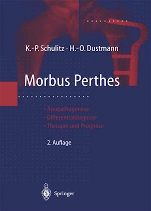 Morbus Perthes