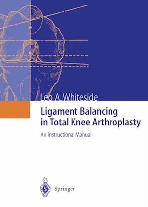 Ligament Balancing in Total Knee Arthroplasty