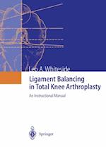 Ligament Balancing in Total Knee Arthroplasty