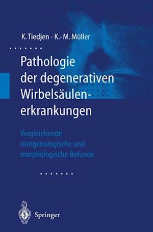 Pathologie der degenerativen Wirbelsäulenerkrankungen