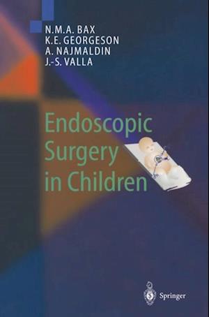 Endoscopic Surgery in Children