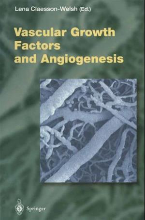 Vascular Growth Factors and Angiogenesis