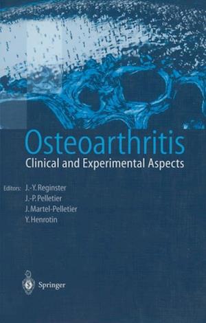 Osteoarthritis