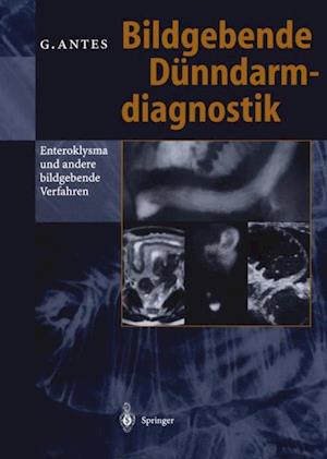 Bildgebende Dünndarmdiagnostik