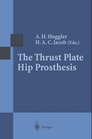 Thrust Plate Hip Prosthesis