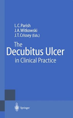 Decubitus Ulcer in Clinical Practice