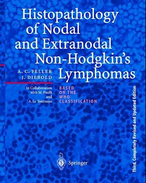 Histopathology of Nodal and Extranodal Non-Hodgkin’s Lymphomas