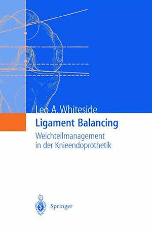 Ligament Balancing