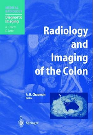 Radiology and Imaging of the Colon