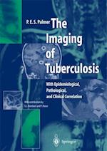 The Imaging of Tuberculosis