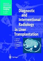 Diagnostic and Interventional Radiology in Liver Transplantation