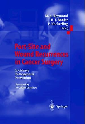 Port-Site and Wound Recurrences in Cancer Surgery