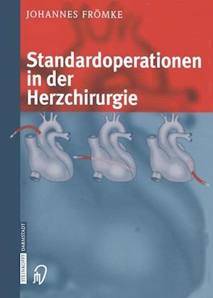 Standardoperationen in der Herzchirurgie