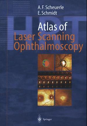 Atlas of Laser Scanning Ophthalmoscopy